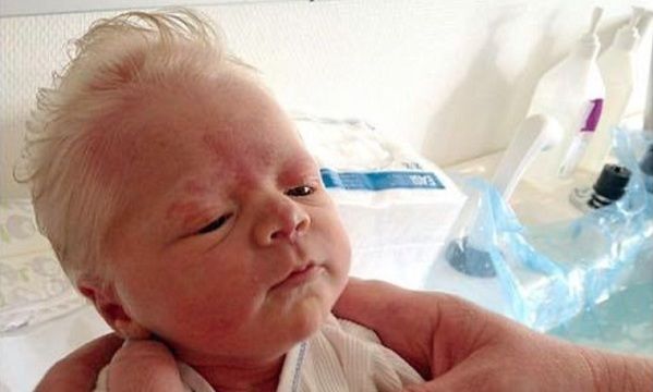 Αυτά τα μωρά μπορεί να μοιάζουν με ηλικιωμένους αλλά είναι πολύ γλυκά!(εικόνες)